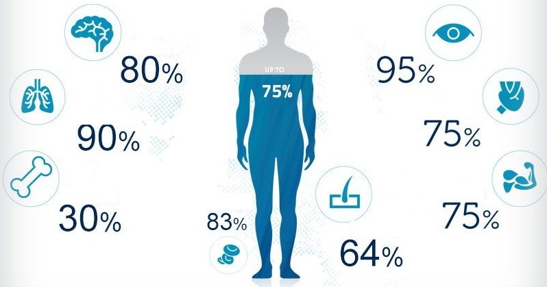 75% cơ thể người là nước