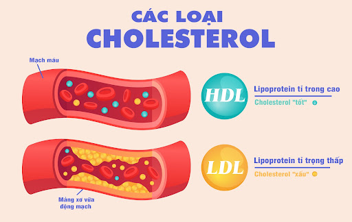Các loại Cholesterol